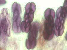 11-19 Saccobolus2.jpg (5031 bytes)