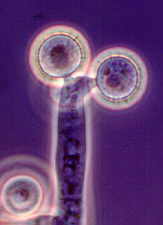 11-26 Basifimbria2.jpg (4407 bytes)