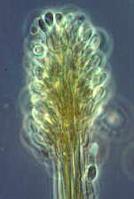 11-35 Cephalotrichum2.jpg (5076 bytes)