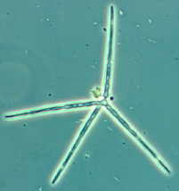 11-45 Lemonniera spore.jpg (3728 bytes)