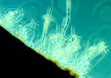 11-47 Lemonniera sporulating.jpg (5051 bytes)