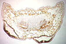 11-69 Lophodermium needle ts.jpg (7322 bytes)