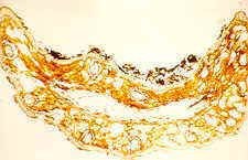 11-81 surface deposits.jpg (7665 bytes)