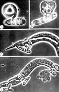 15-11 constricting rings4.jpg (11578 bytes)