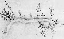 15-18 Verticillium.jpg (4802 bytes)