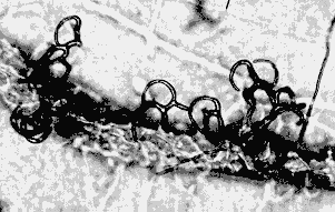 15-2 adhesive nets.gif (12116 bytes)