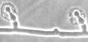 15-5 Nematoctonus knobs.jpg (4917 bytes)