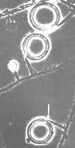 15-6 detachable rings.jpg (6259 bytes)