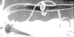 15-8 constricting rings.jpg (5749 bytes)