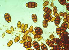 21-13 Pithomyces.jpg (9116 bytes)