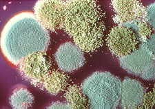 21-14 Aspergillus Penicillium.jpg (9583 bytes)