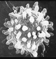 23-18 Histoplasma.jpg (7387 bytes)