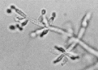 4 Trichoderma.jpg (12460 bytes)