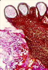 dothid9.jpg (37740 bytes)