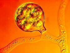 oogonium.jpg (5735 bytes)