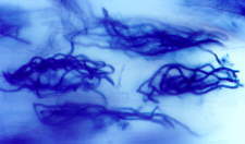 orchid mycorrhiza1.jpg (5979 bytes)