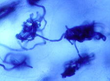 orchid mycorrhiza3.jpg (7242 bytes)