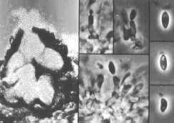 phacid4.jpg (7426 bytes)