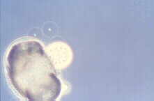 pollen1.jpg (2511 bytes)