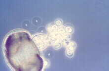 pollen2.jpg (3116 bytes)