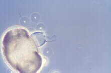 pollen4.jpg (2643 bytes)