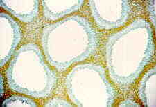 polypor3.jpg (5197 bytes)