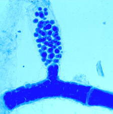 saprolegnialean zoosporangia1.jpg (7873 bytes)