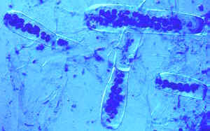 saprolegnialean zoosporangia2.jpg (10721 bytes)