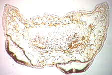 11-69 Lophodermium needle ts.jpg (7322 bytes)