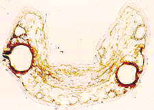 11-70 Fusicoccum needle ts.jpg (6855 bytes)