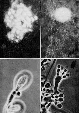 11 Limnoperdon plate.jpg (50561 bytes)